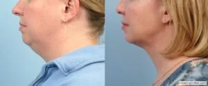 facetite201810