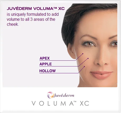 voluma1